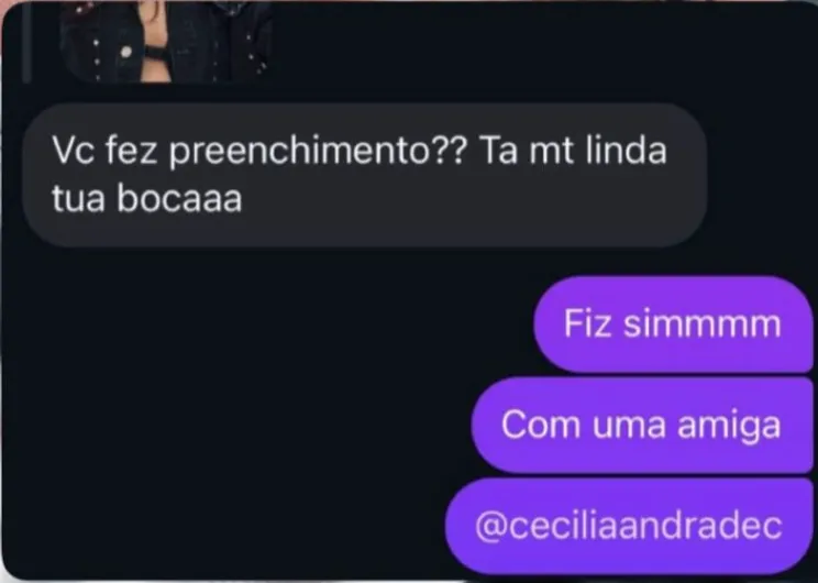 Mensagem de paciente sobre preenchimento labial, recebida pelo Instagram